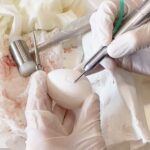 Sinuslift: Ein praktischer Kurs mit Hands-on-Training