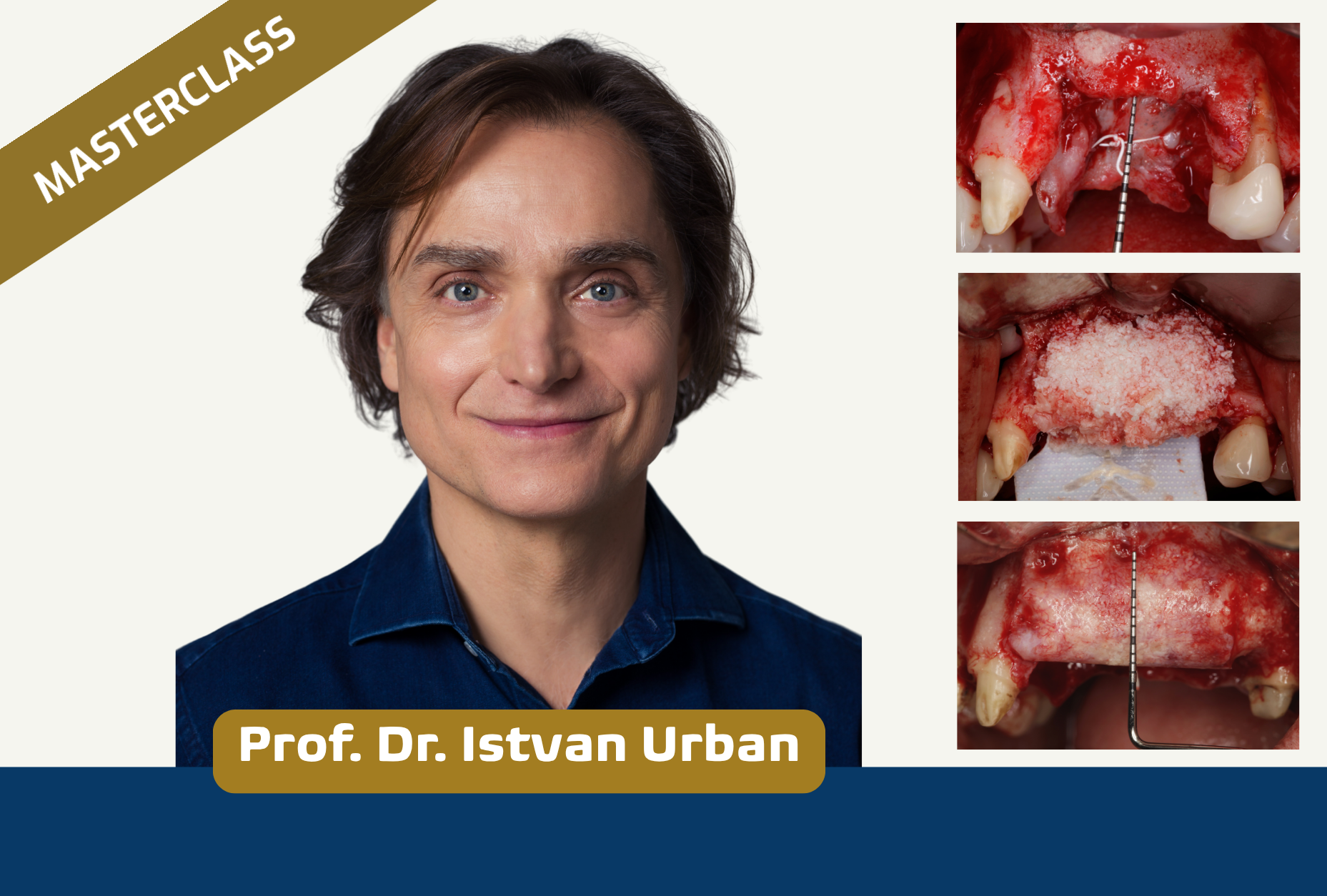 Theoretische Aspekte der Knochenaugmentation